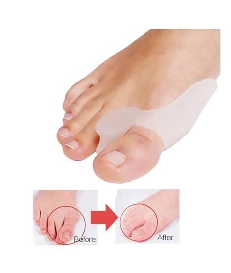 iShopping - Ferozi Traders 1 Pair Separator Pain Relief Thumb